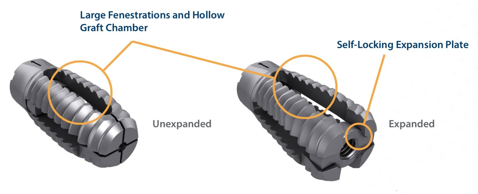 VariLift-LX Expanded Unexpanded