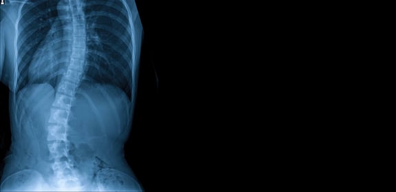 spine bending-1